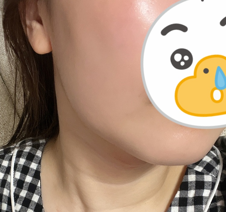 턱라인이 아주 달라졌어요~~