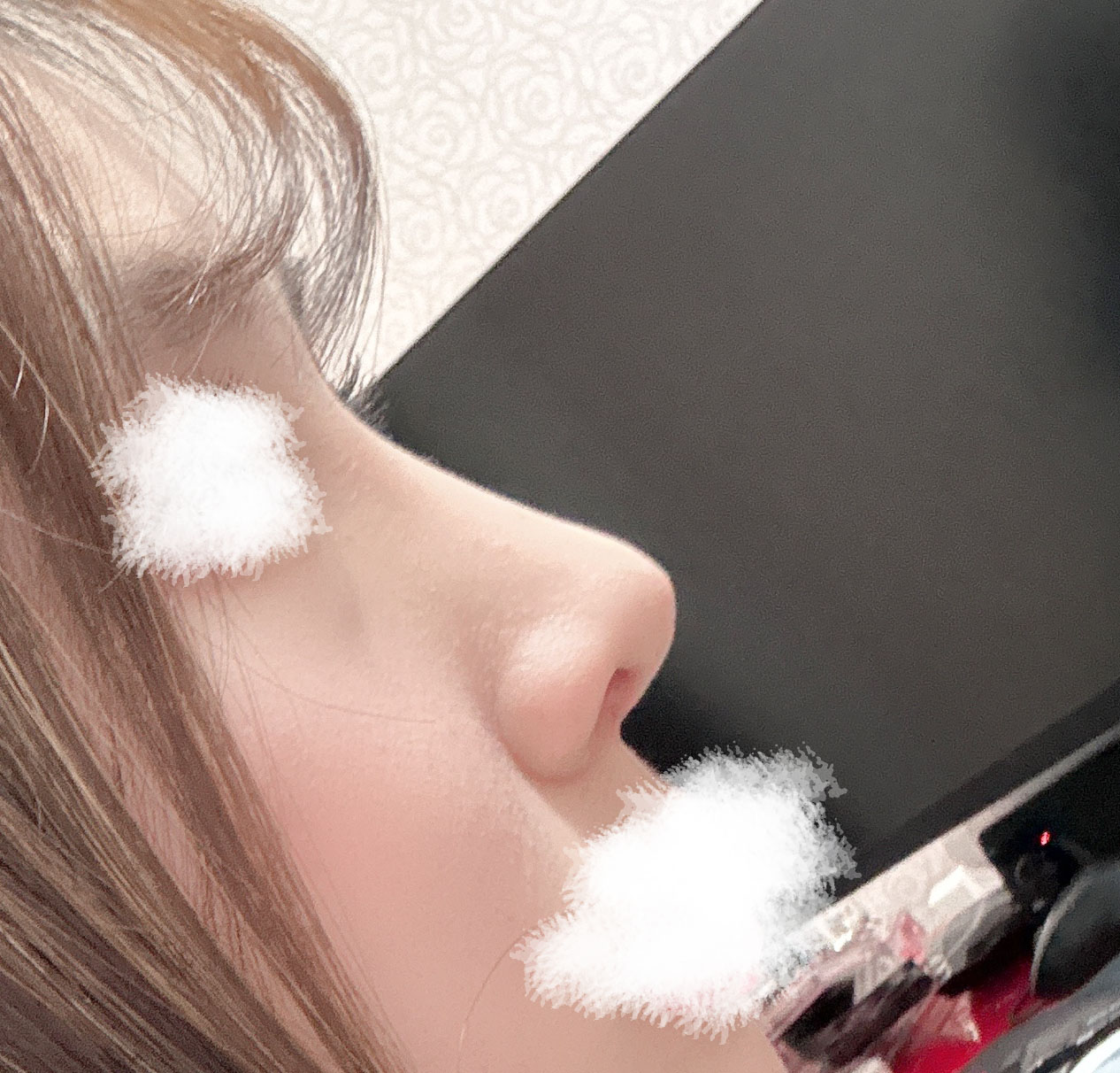 코, 눈트임 5개월차후기 가져왔슴당