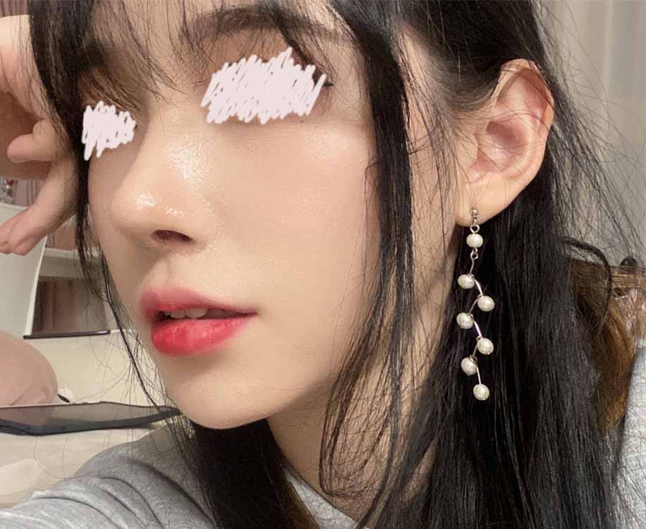 코 1달째 후기에용~