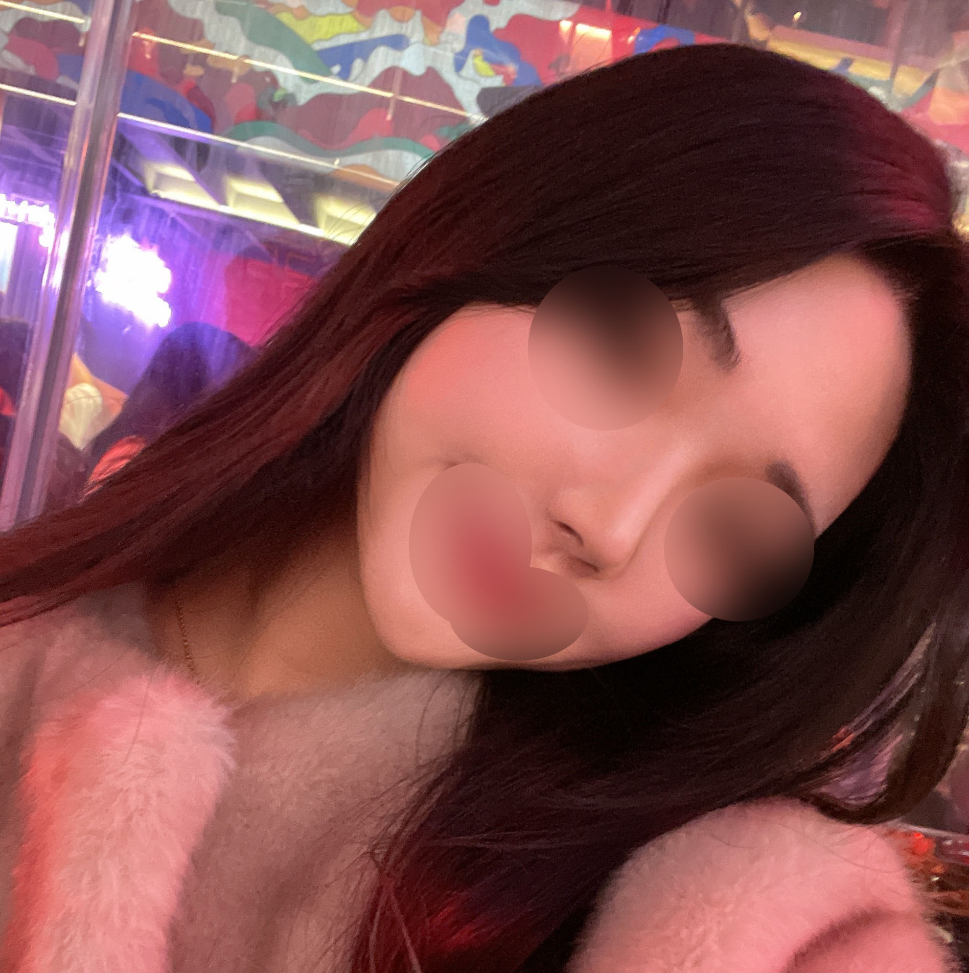 무보형물코수술 4개월 지난 후기^0^*