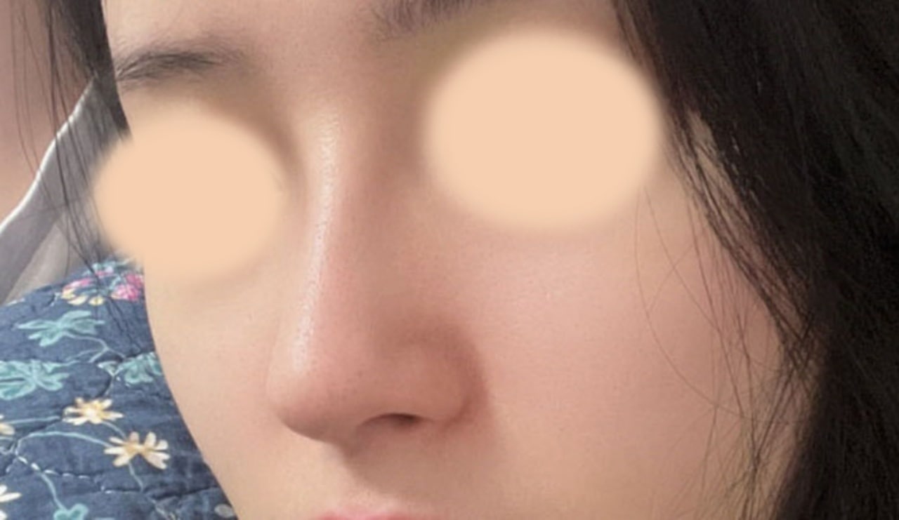 원하는 모양대로 잘돼서 만족해요~