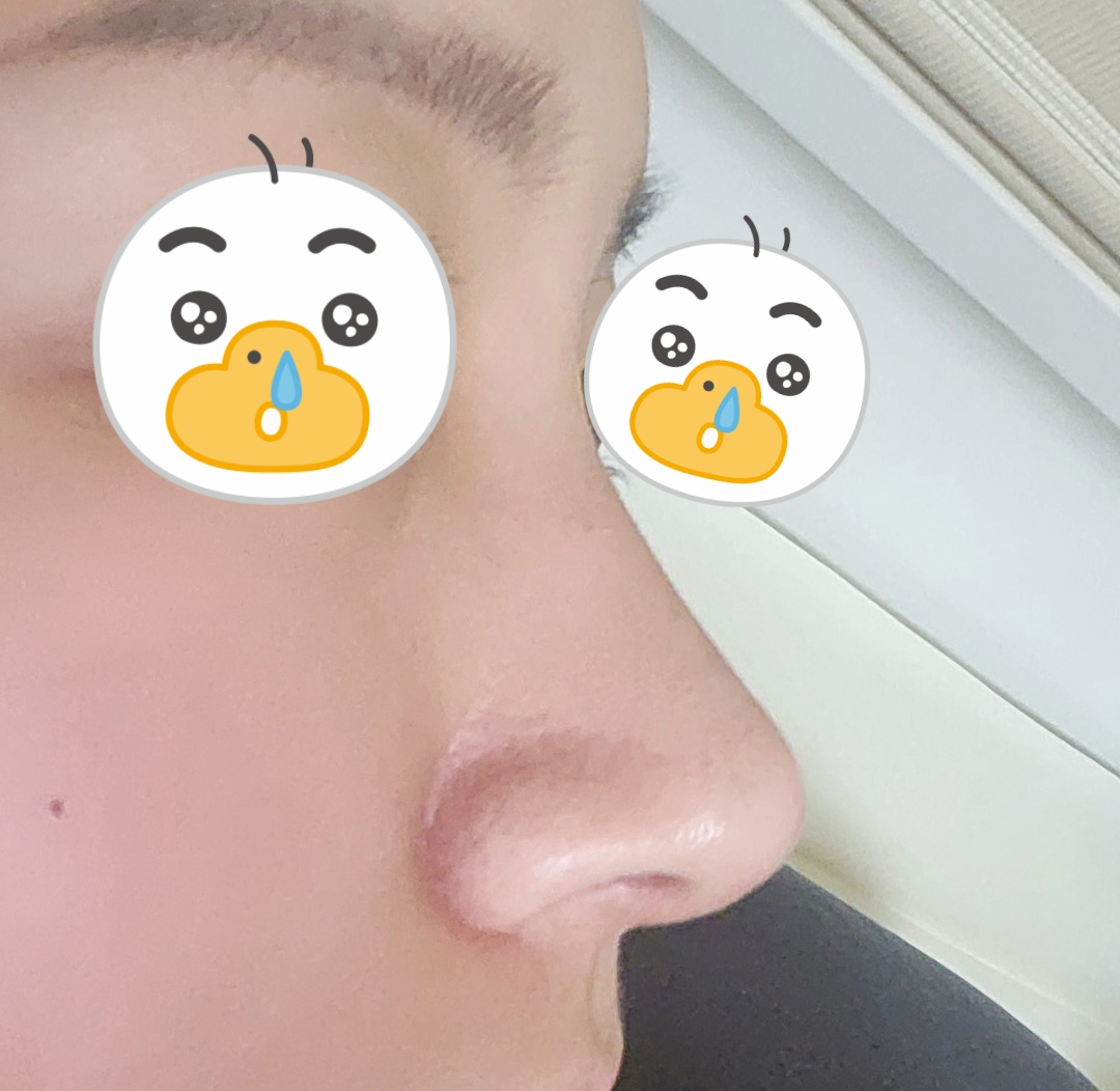 상담도 좋았구 결과도 만족중!<1달차>