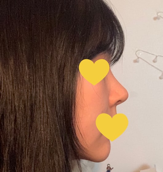 짝눈도  교정되고 라인도 깔끔해서 좋습니다!