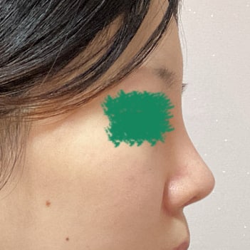 이쁜 코 만들어주셔서 감사합니다 :)