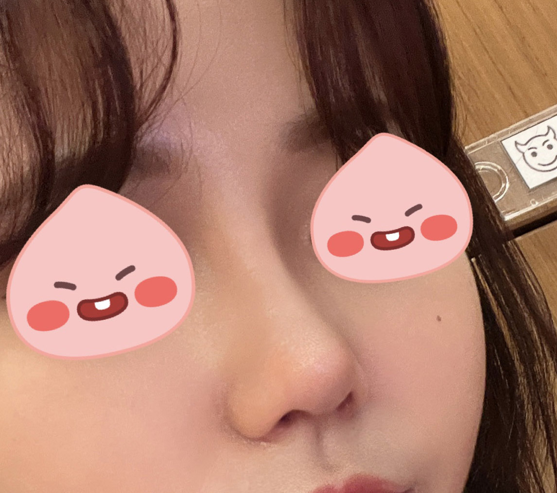 코하구 예뻐졌다고 많이들어요ㅎㅎ