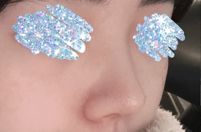 코 자연스럽게 잘 된 후기!!