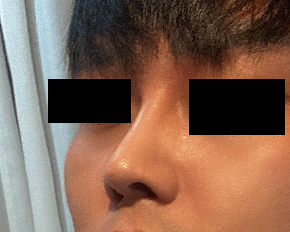 기능코 2개월됐어요