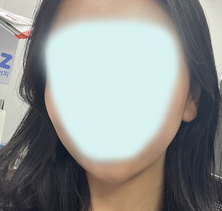 투턱 컴플렉스 이제 없어요!!