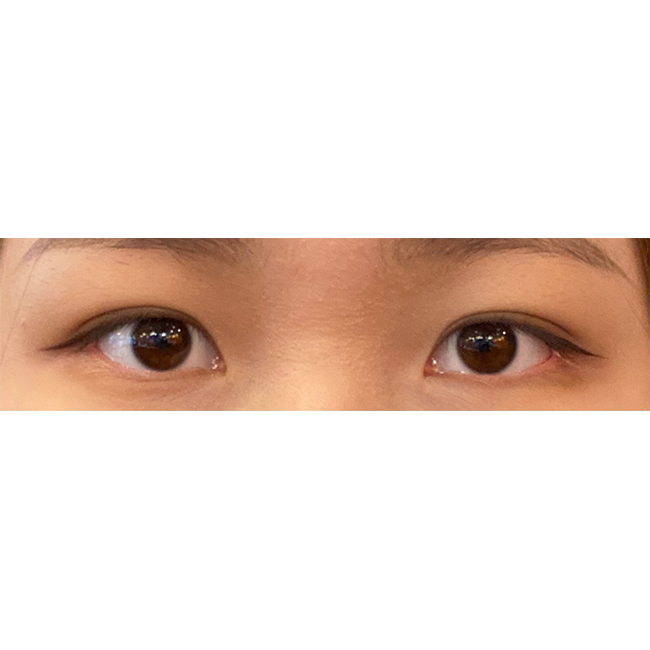 다른 성형받아두 유원장님 찾아갈거에용~