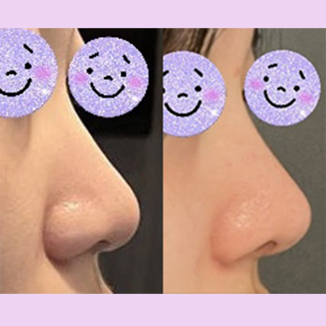 원장님 친근하시고 실력도 좋으세요!