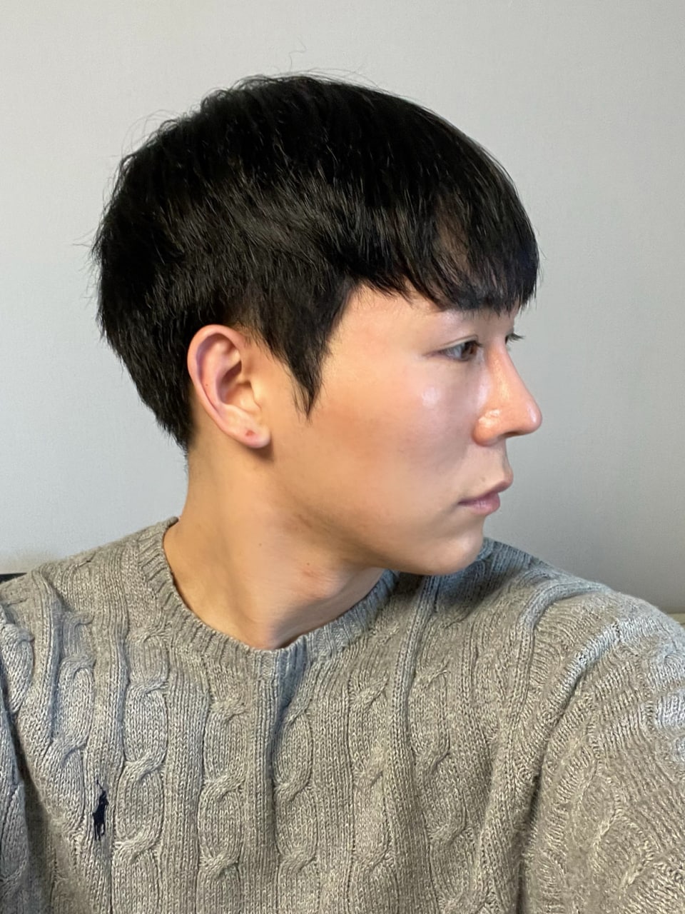 현재 수술결과는 매우만족스러워요