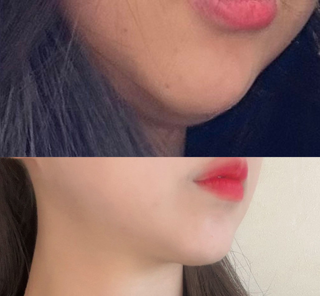 얼지흡하니까 완죤 갸름갸름해짐요ㅎㅎ