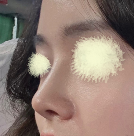 다들 코 어디서 했냐고 물어봄!