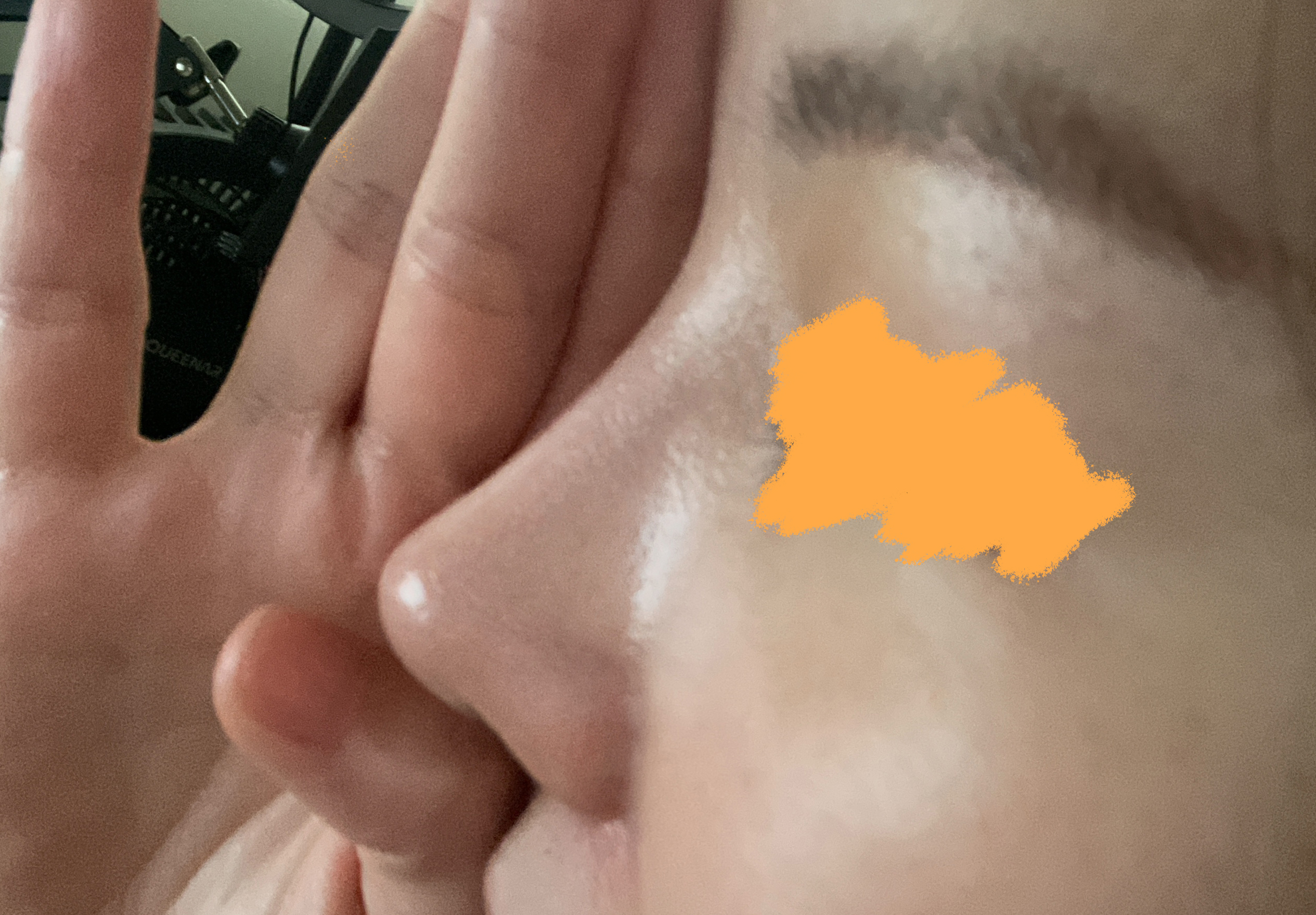 코재수술 정말 대만족이에요!