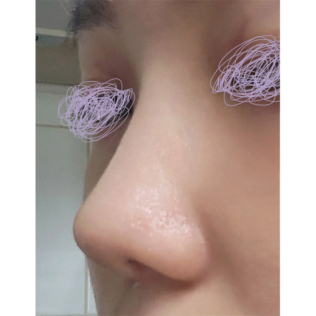 코하고나서 자신감상승했어요ㅎㅎ