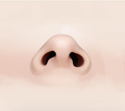 콧구멍 비대칭 또는 교정